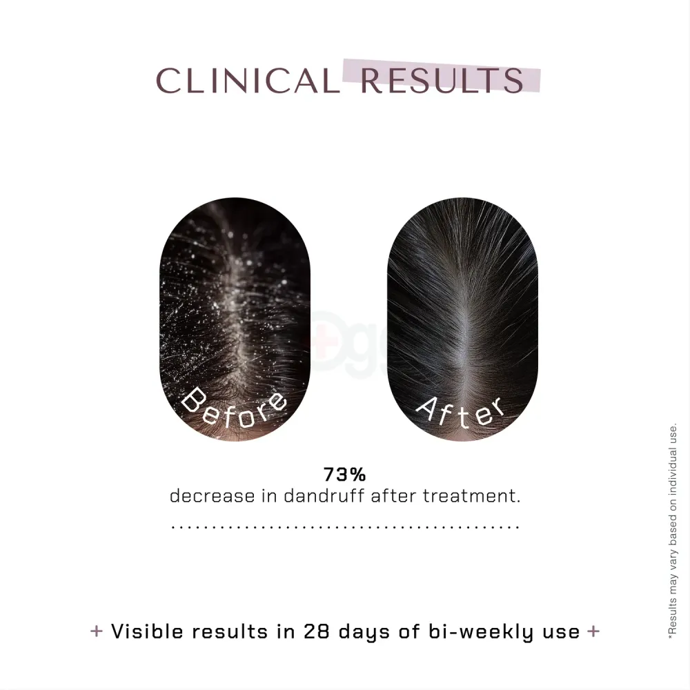 The Remedist by Dr Rhazes Ketonasel+Anti Dandruff Shampoo  