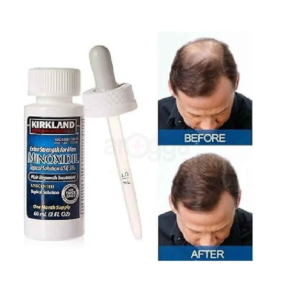 Kirkland 5% Minoxidil Extra Strength Hair Loss & Hair Regrowth Treatment for Men 60ml  