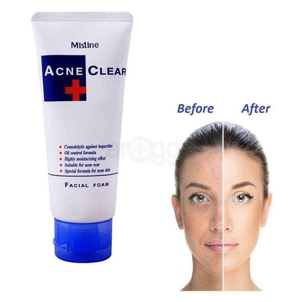 Mistine Acne Clear Facial Foam  