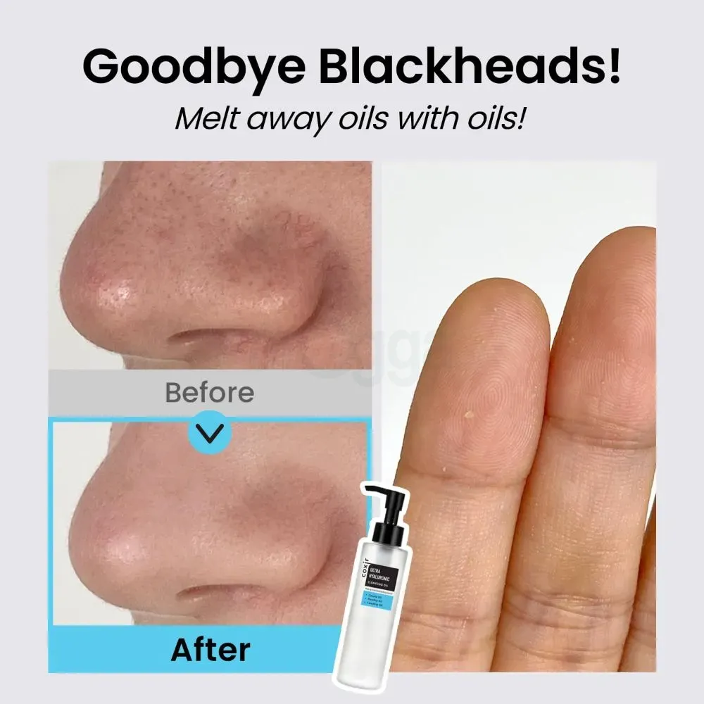 Coxir Ultra Hyaluronic Cleansing Oil Makeup & Blackhead Melting Remover  