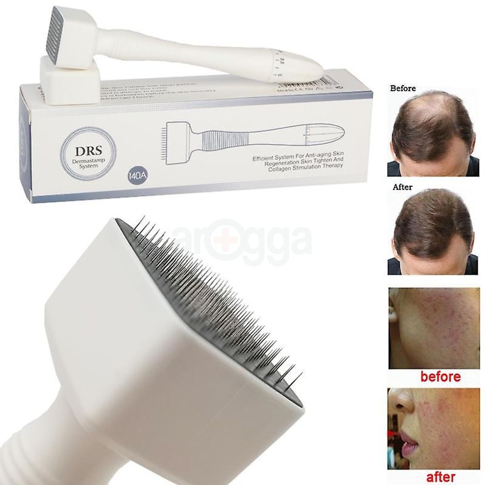 Derma Roller (MRS Dermasstamp System)  