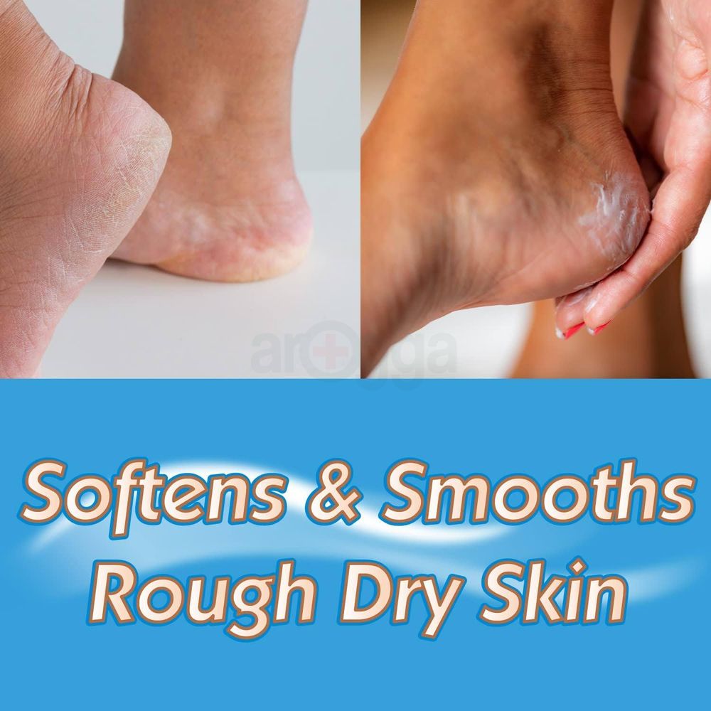 MasterPlast Moisturises & Hydrates Heel Balm for Dry, Cracked & Chapped Heels  