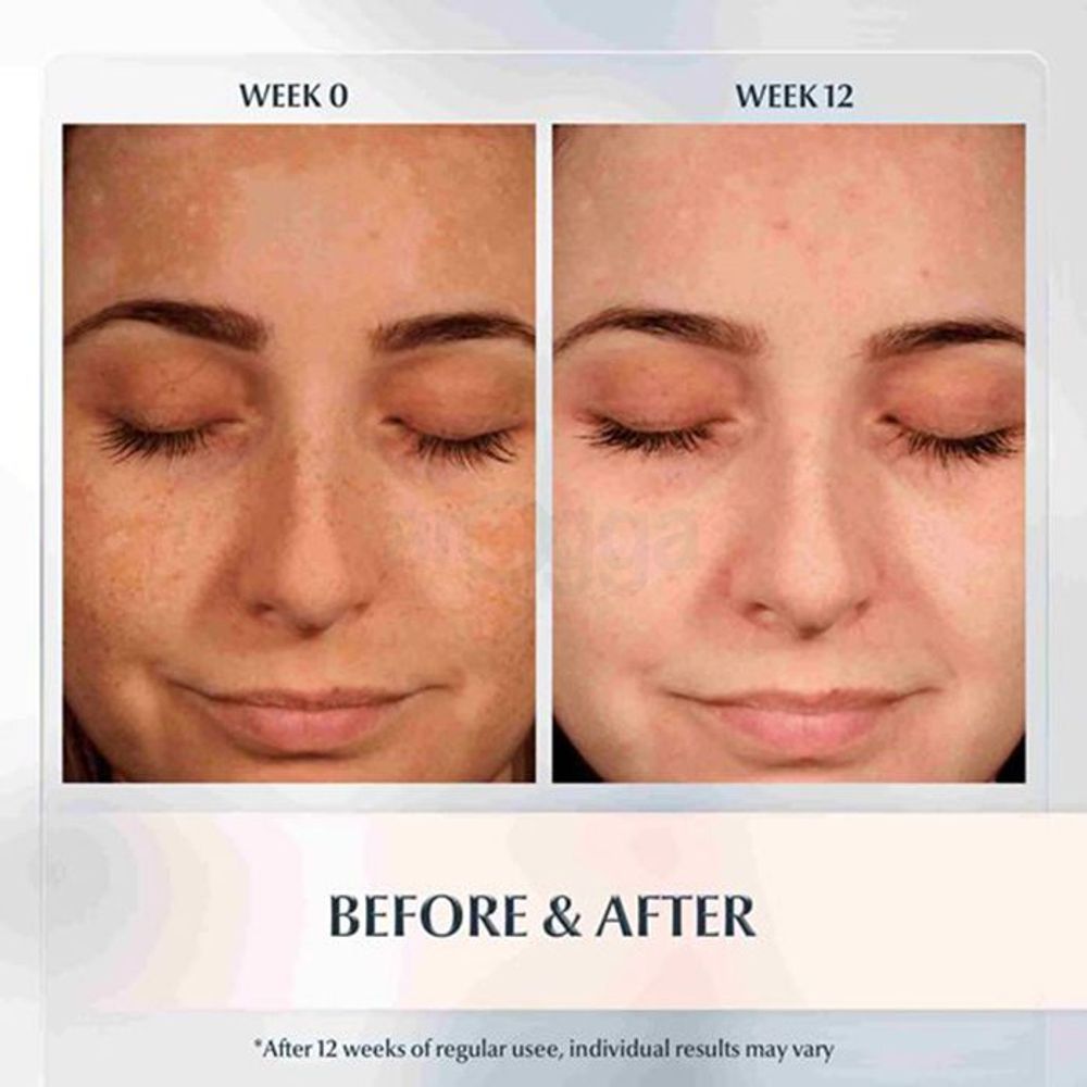 Eucerin Even Skin Spotless Brightening Gentle Cleansing Foam for All Skin Types  