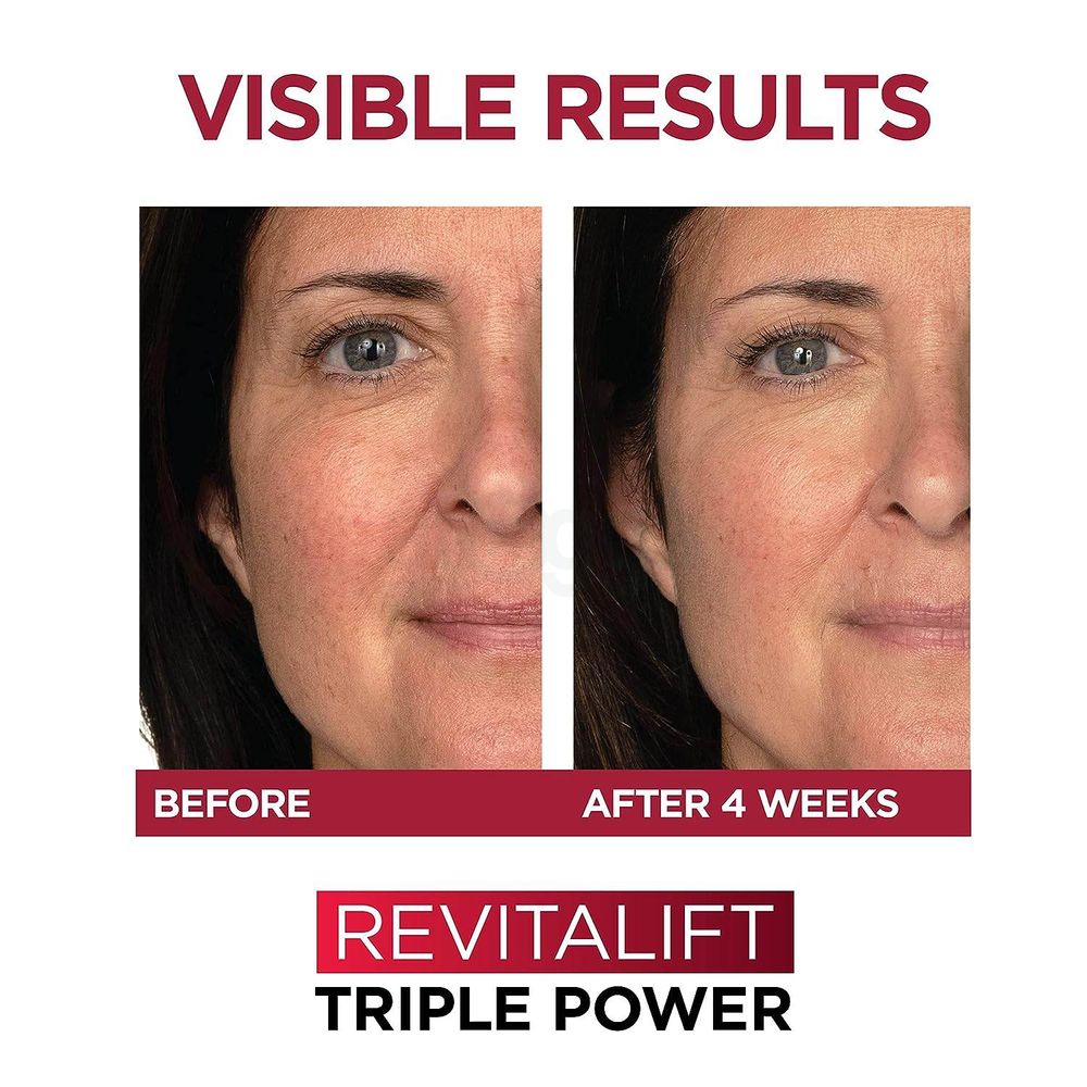 Loreal Paris Revitalift Triple Action Day Cream with Hyaluronic Acid+Vitamin C+ Pro-Retinol  