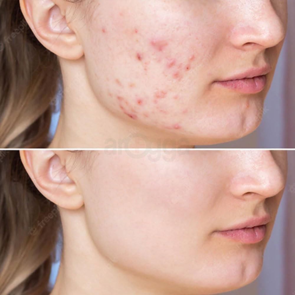 Care:Nel Anti Melasma Cica Treatment Toner  