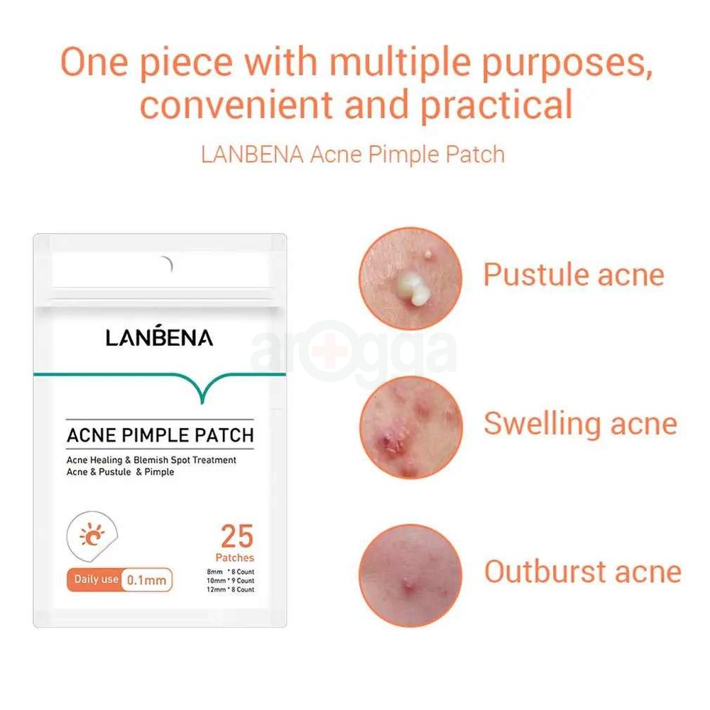 Lanbena Acne Pimple Patch Daily Use - 25 Patches  