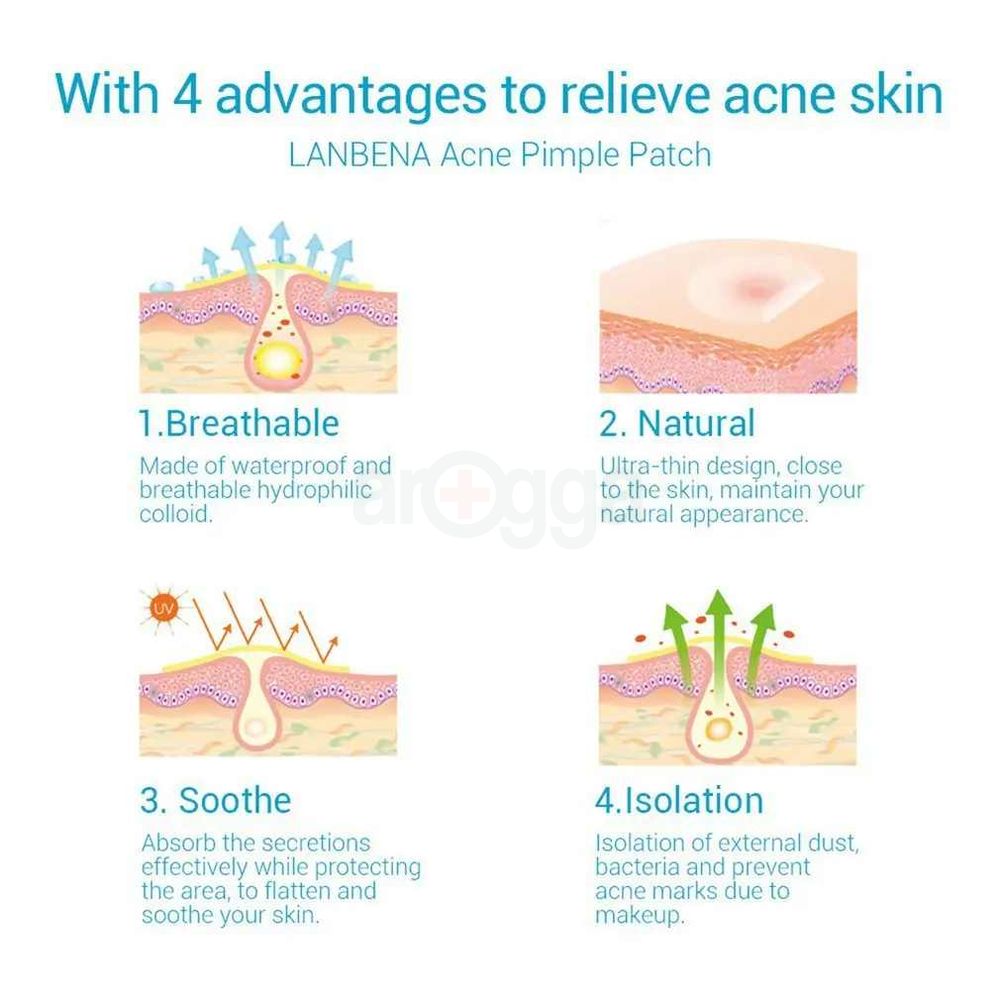 Lanbena Acne Pimple Patch Daily Use - 25 Patches  