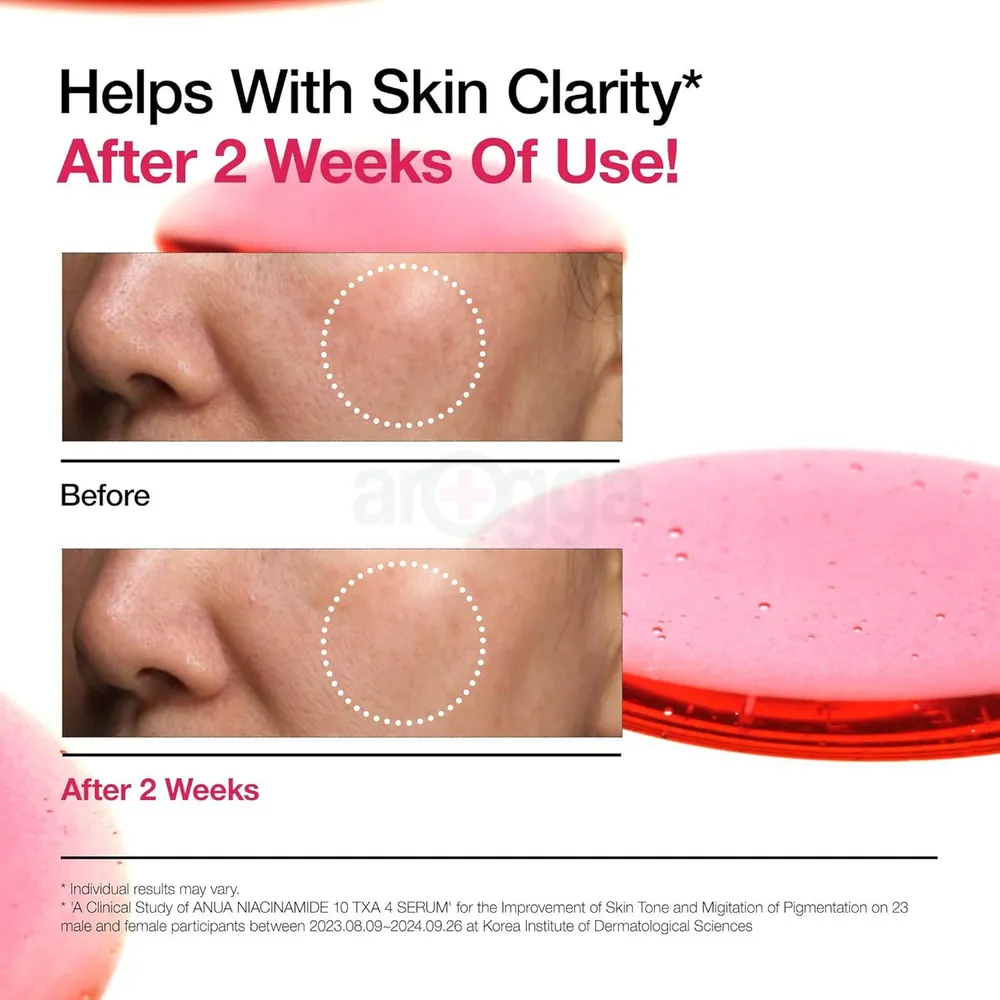 Anua Niacinamide 10% + TXA 4% Serum 30ml  
