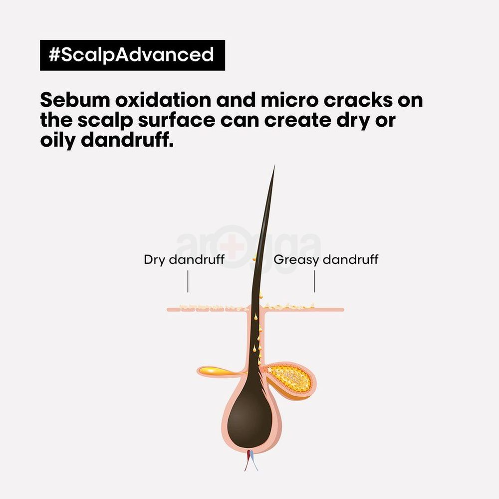 Loreal Paris Professionnel Scalp Advanced Anti-dandruff Dermo-Carifier Shampoo  