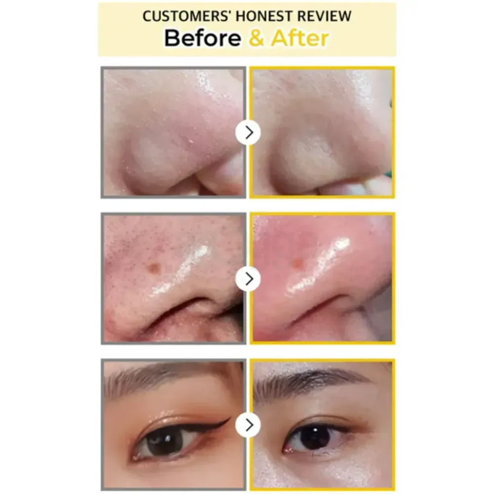 Iunik Calendula Complete Cleansing Oil  