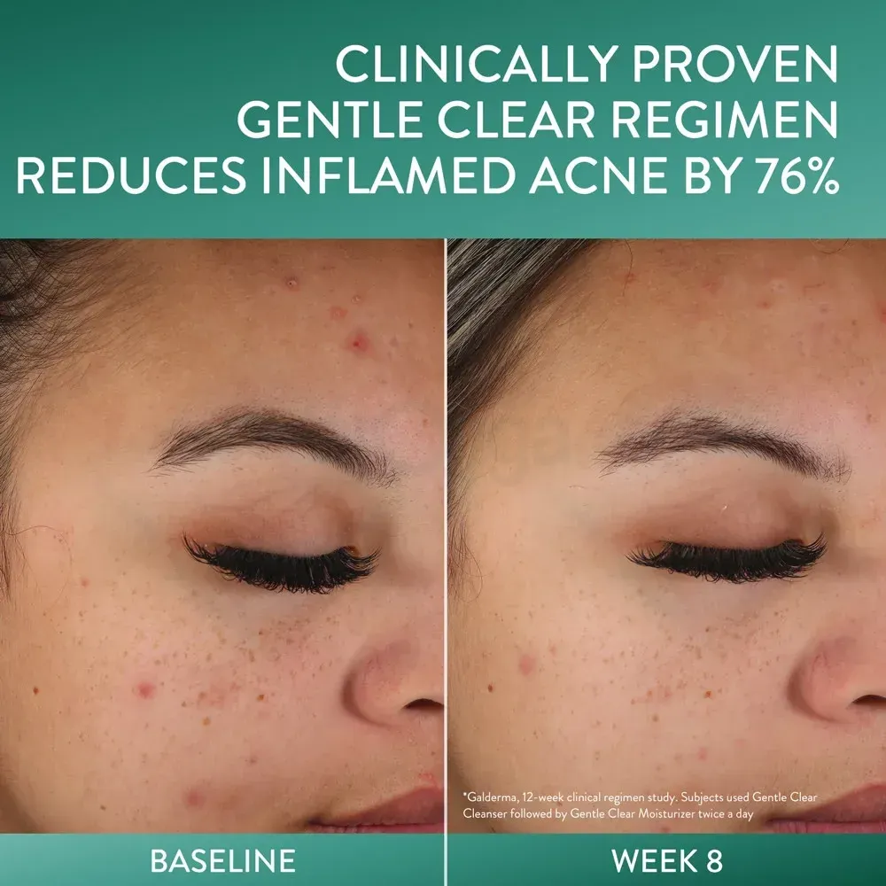 Cetaphil Gentle Clear Mattifying Acne Moisturizer  