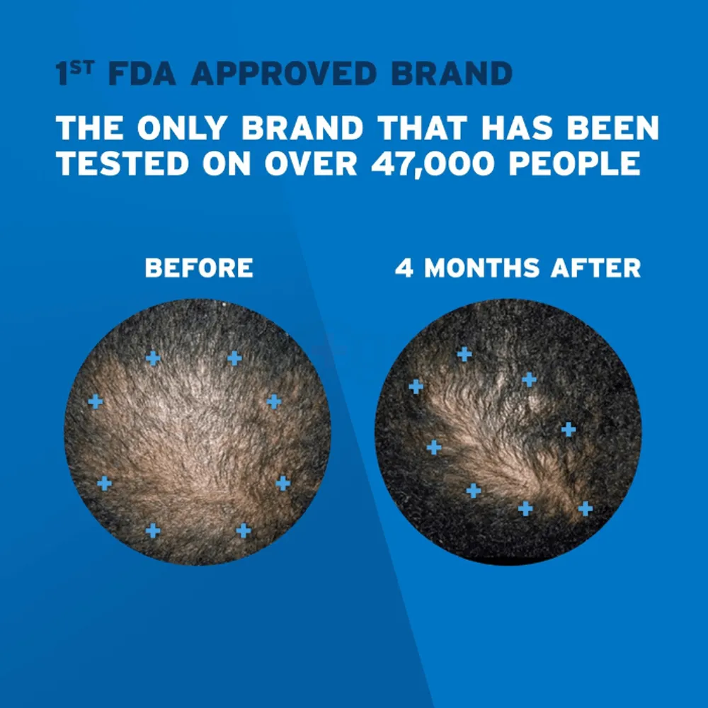 Men's Rogaine 5% Minoxidil Topical Solution Hair Regrowth Treatment 60ml  