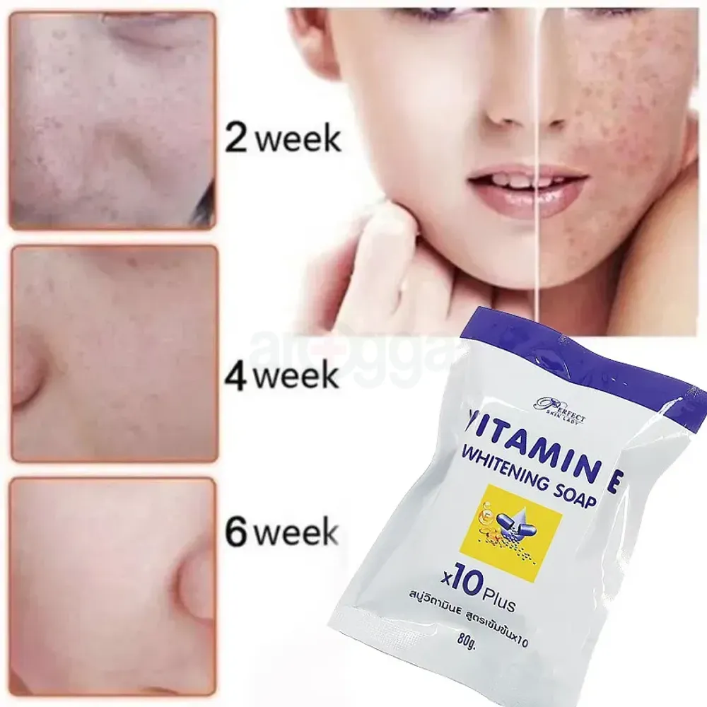Perfect Skin Lady Vitamin E Whitening Soap  