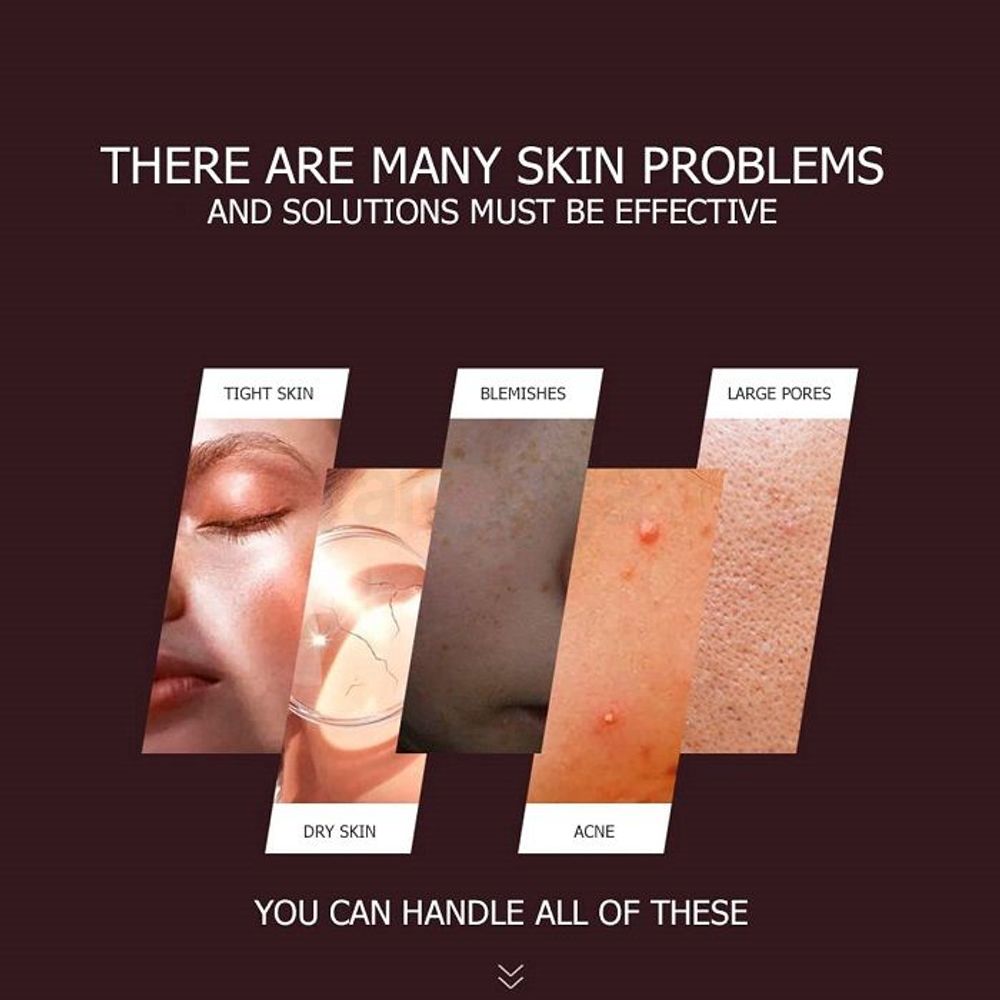 Bioaqua Moistueizing Pink Aloe Vera Gel - 300g  