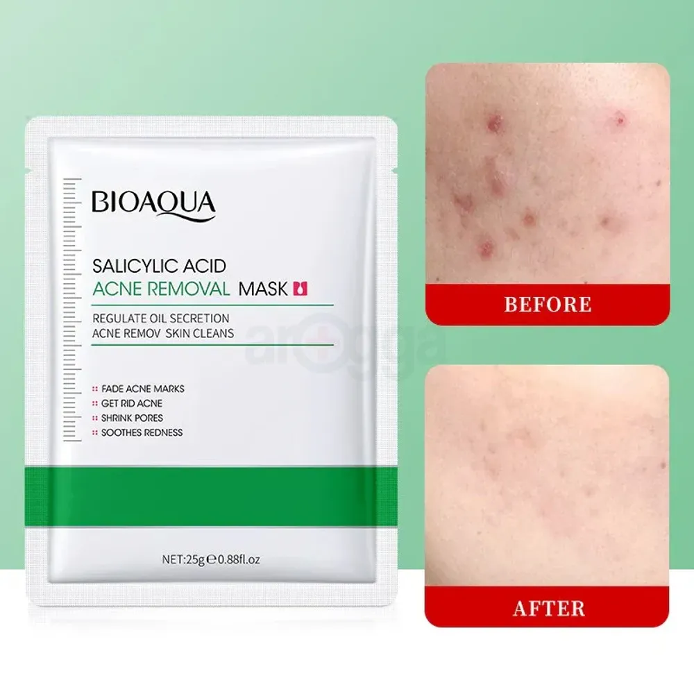 Bioaqua Salicylic Acid Acne Removal Sheet Mask - 25g  
