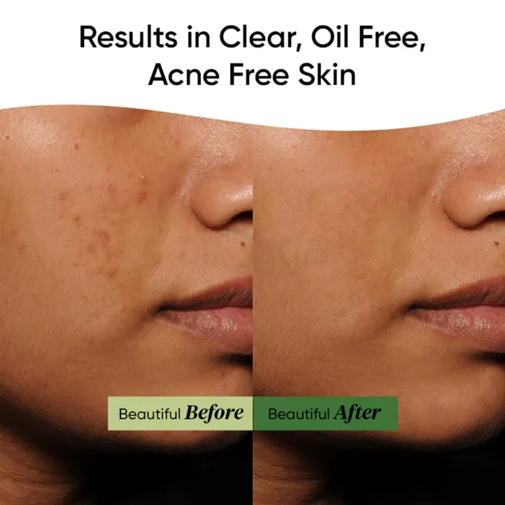 Dot and Key Cica Calming Skin Renewing Night Gel with Green Tea and Niacinamide  