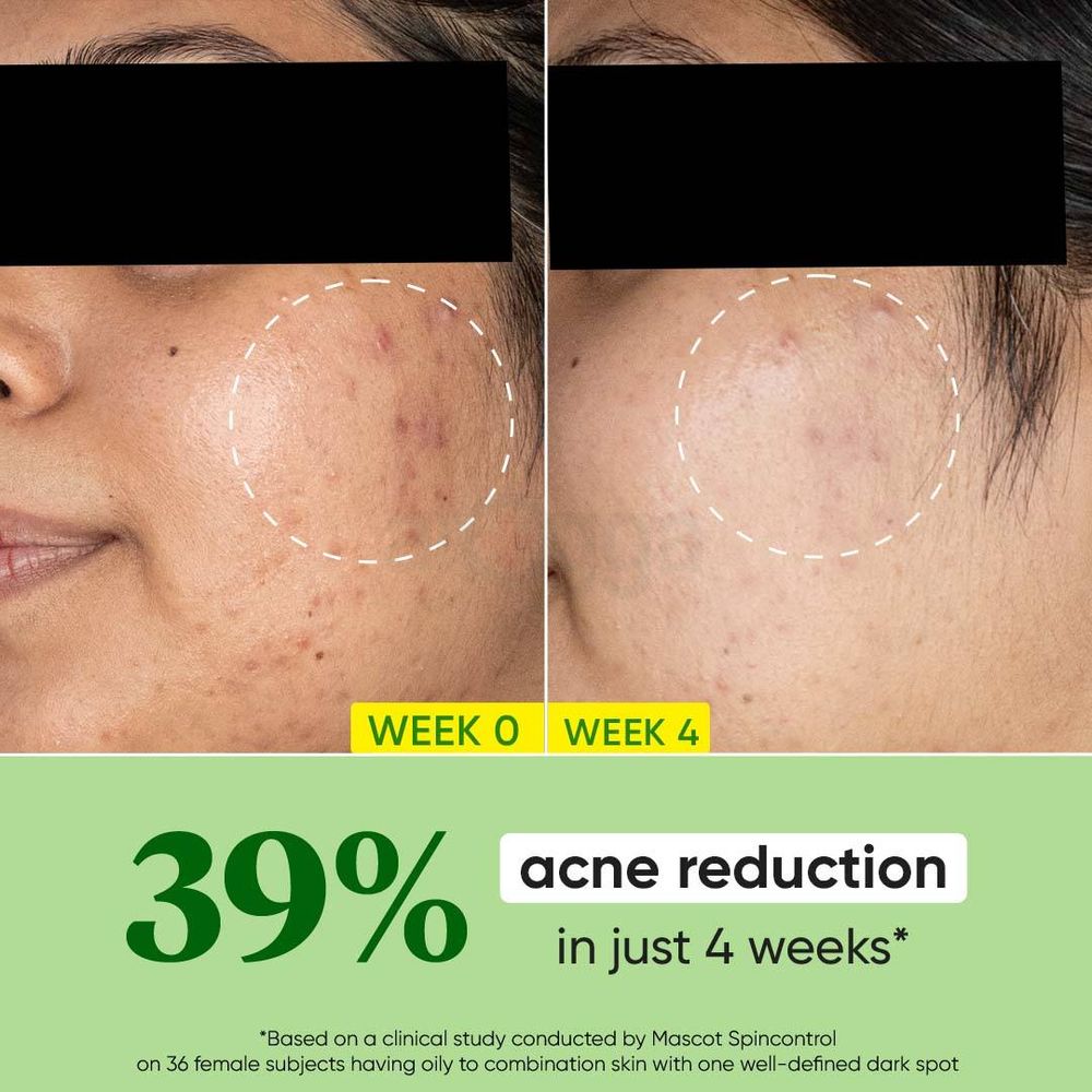 Dot and Key Cica Calming Skin Renewing Night Gel with Green Tea and Niacinamide  