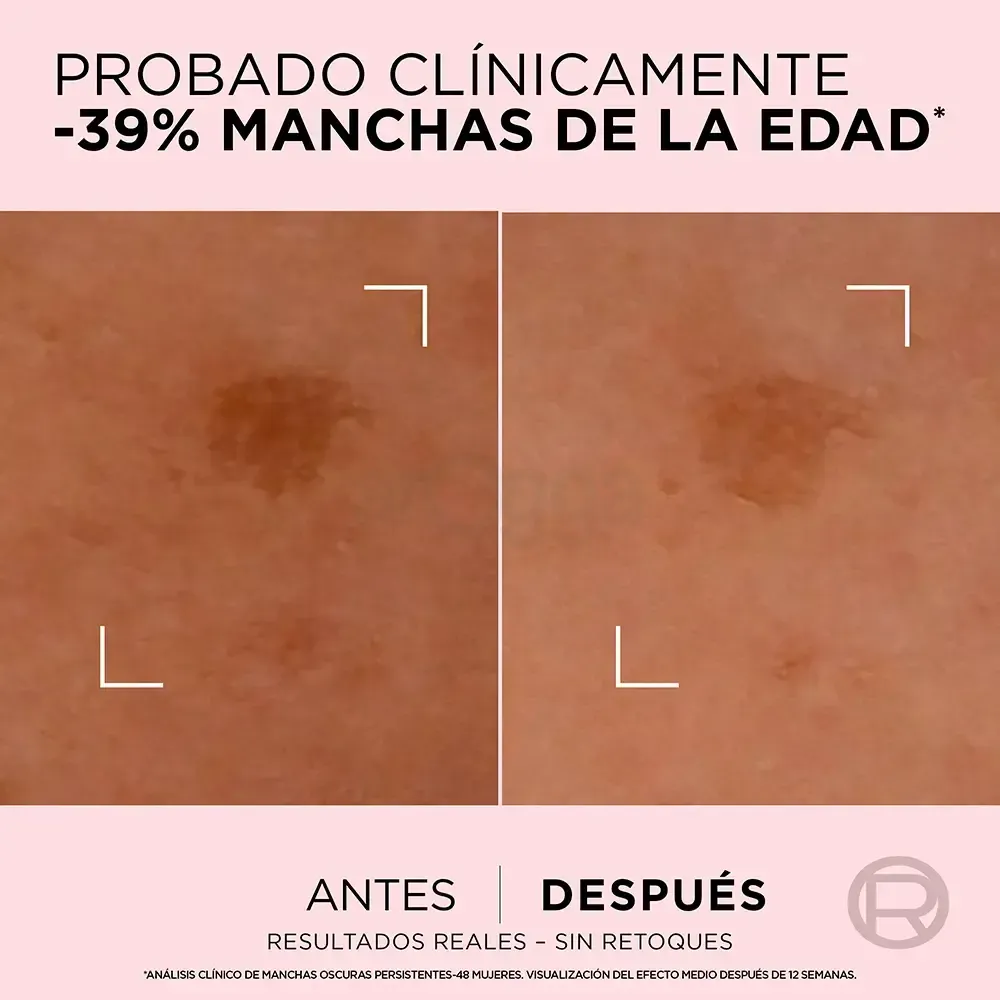 Loreal Paris Age Perfect Dark Spot Corrector Serum with Peony Native Cells and Niacinamide For Mature Skin   