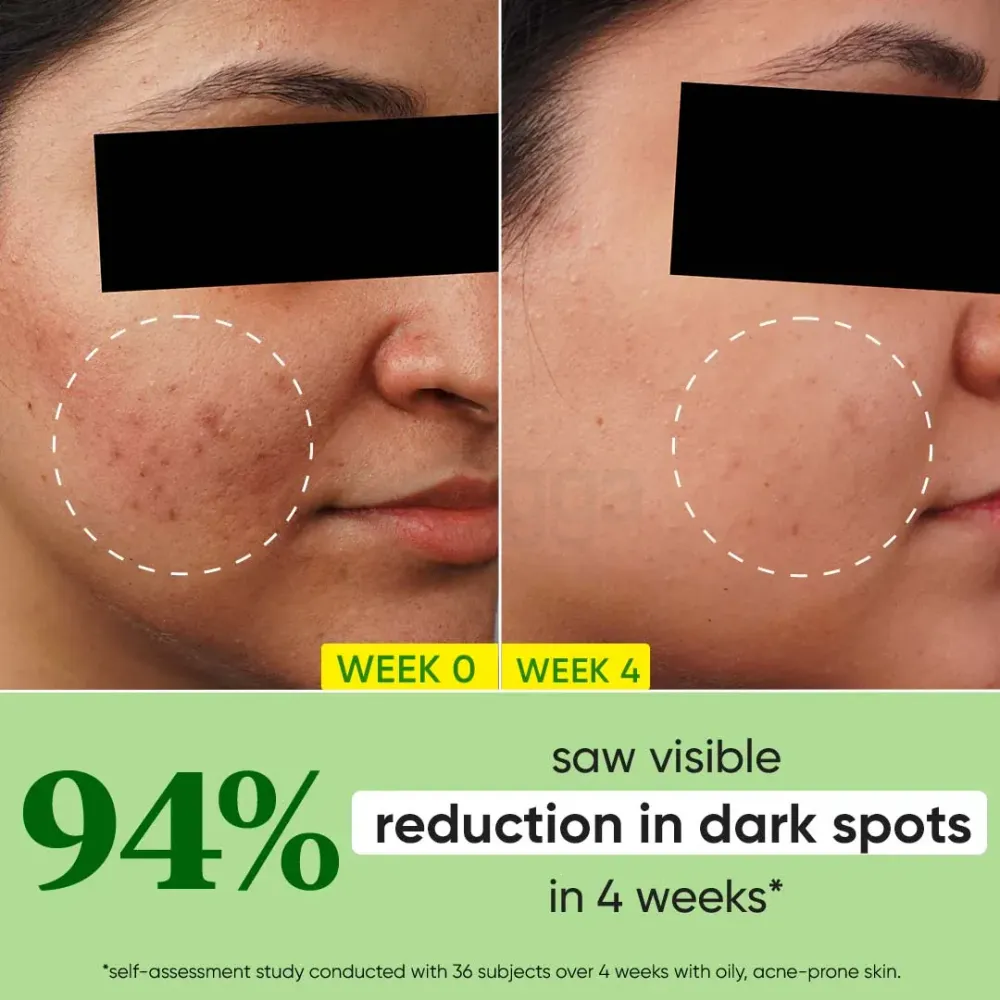 Dot and Key Cica + 10% Niacinamide Spot Reduction Face Serum with Alpha Arbutin  