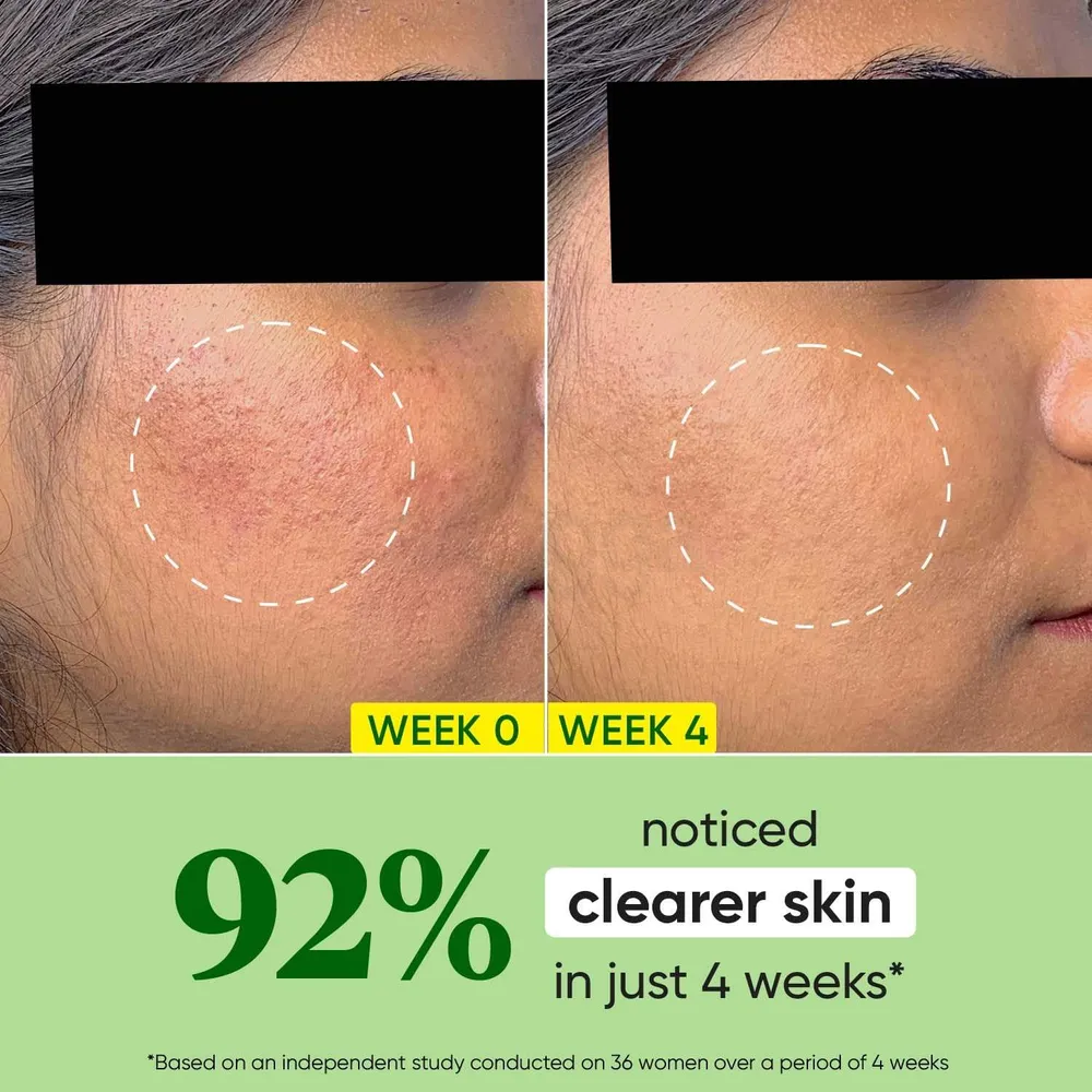 Dot and Key Cica + Niacinamide Oil Free Moisturizer 15ml  