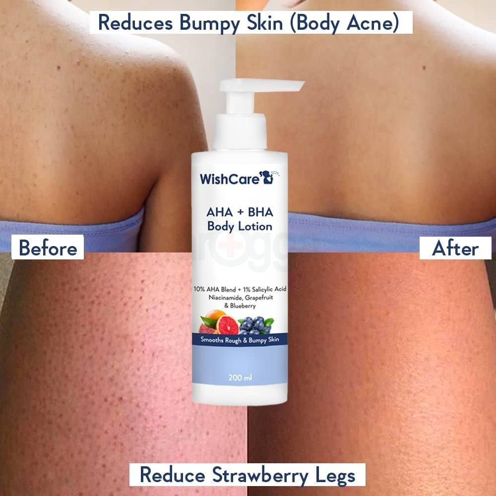 Wishcare AHA BHA Body Lotion with Niacinamide, Grapefruit & Blueberry for Smooths Rough & Bumpy Skin  