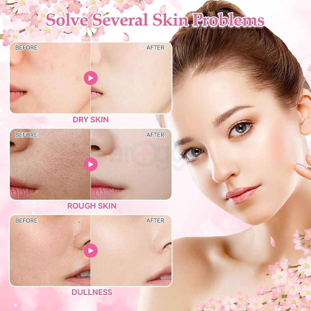 Fenyi Japan Cherry Blossom Skincare Set- Spring Awakening (Cleanser, Toner, Serum, Eye Cream, Facial Cream)  