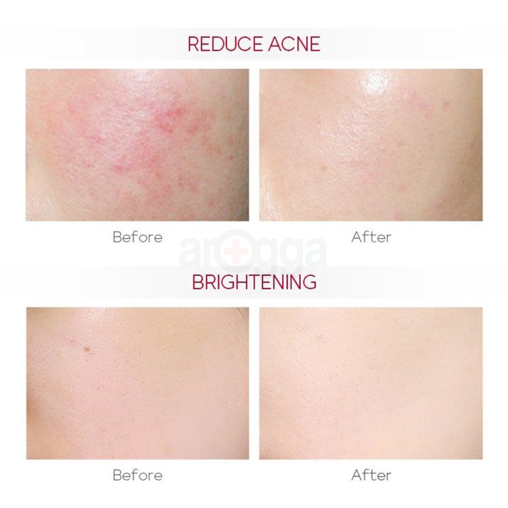 Laikou Pro Niacinamide Brightening Serum  