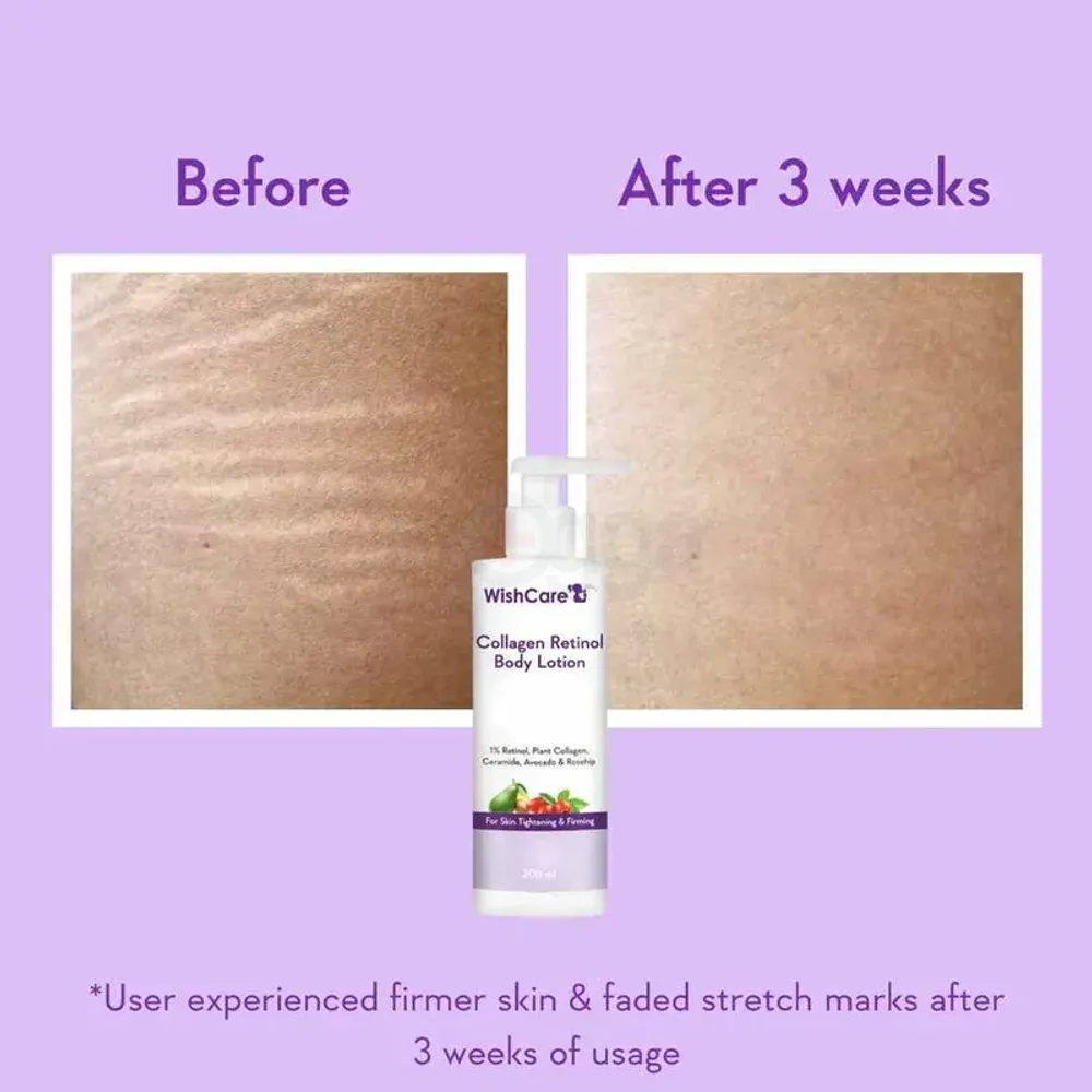 WishCare Collagen Retinol Body Lotion with 1% Retinol,Plant Collagen,Ceramide,Avocado and Rosehip for Skin Tightening and Firming  