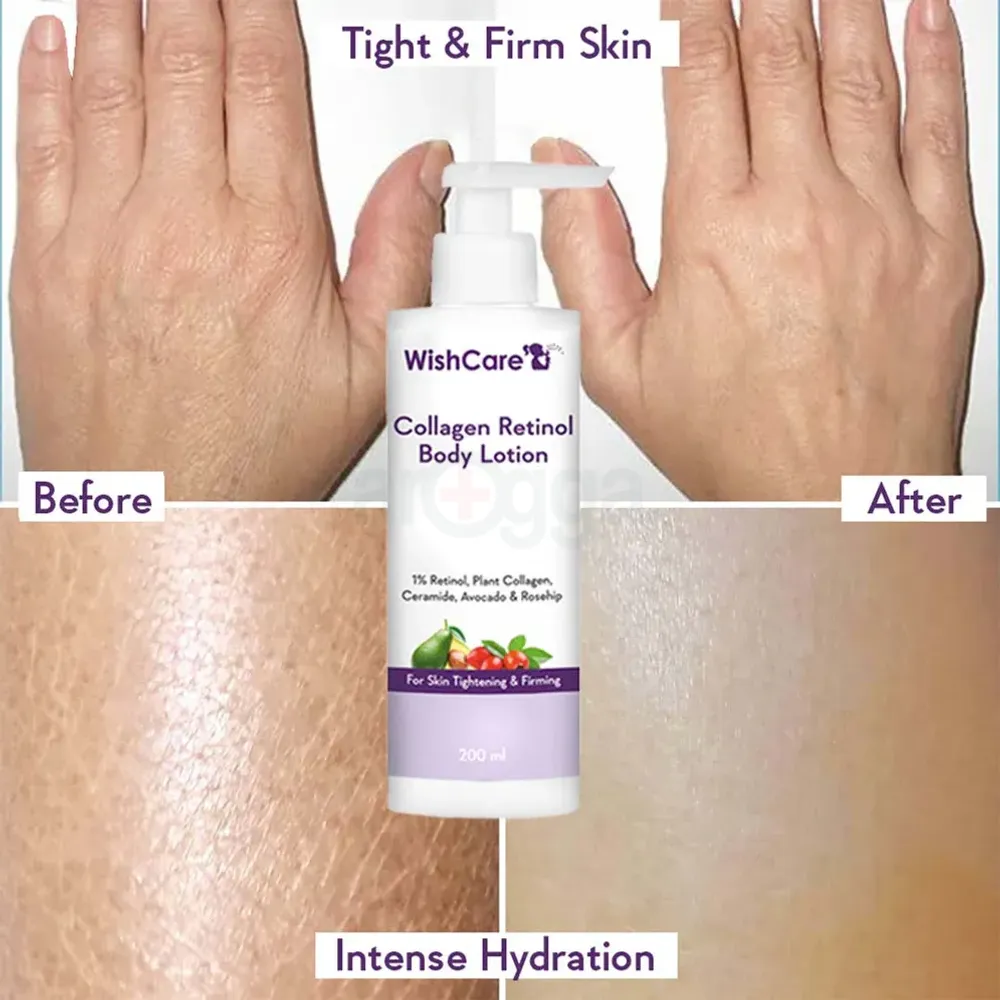 WishCare Collagen Retinol Body Lotion with 1% Retinol,Plant Collagen,Ceramide,Avocado and Rosehip for Skin Tightening and Firming  