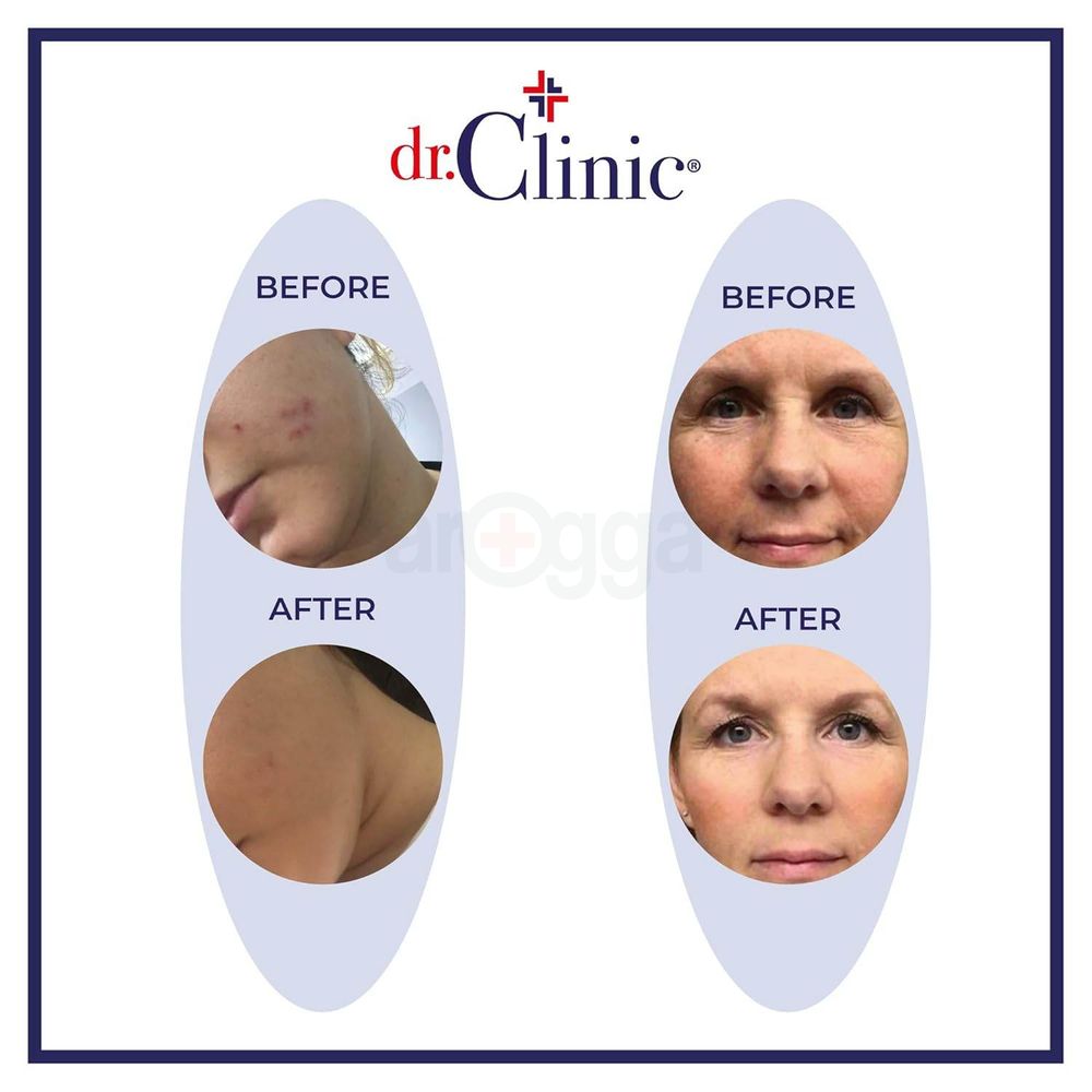 Dr. Clinic Collagen Intense Cream 50ml  