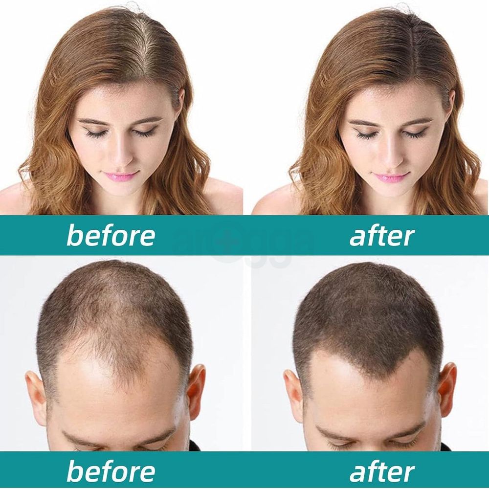 The Ordinary Multi Peptide Serum for Hair Density for All Hair Types 30ml  