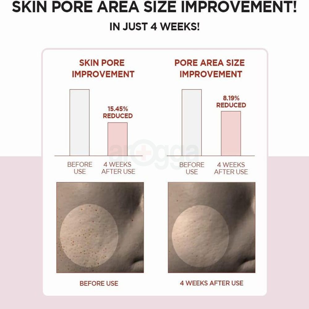 Skin 1004 Madagascar Centella Poremizing Clear Toner  