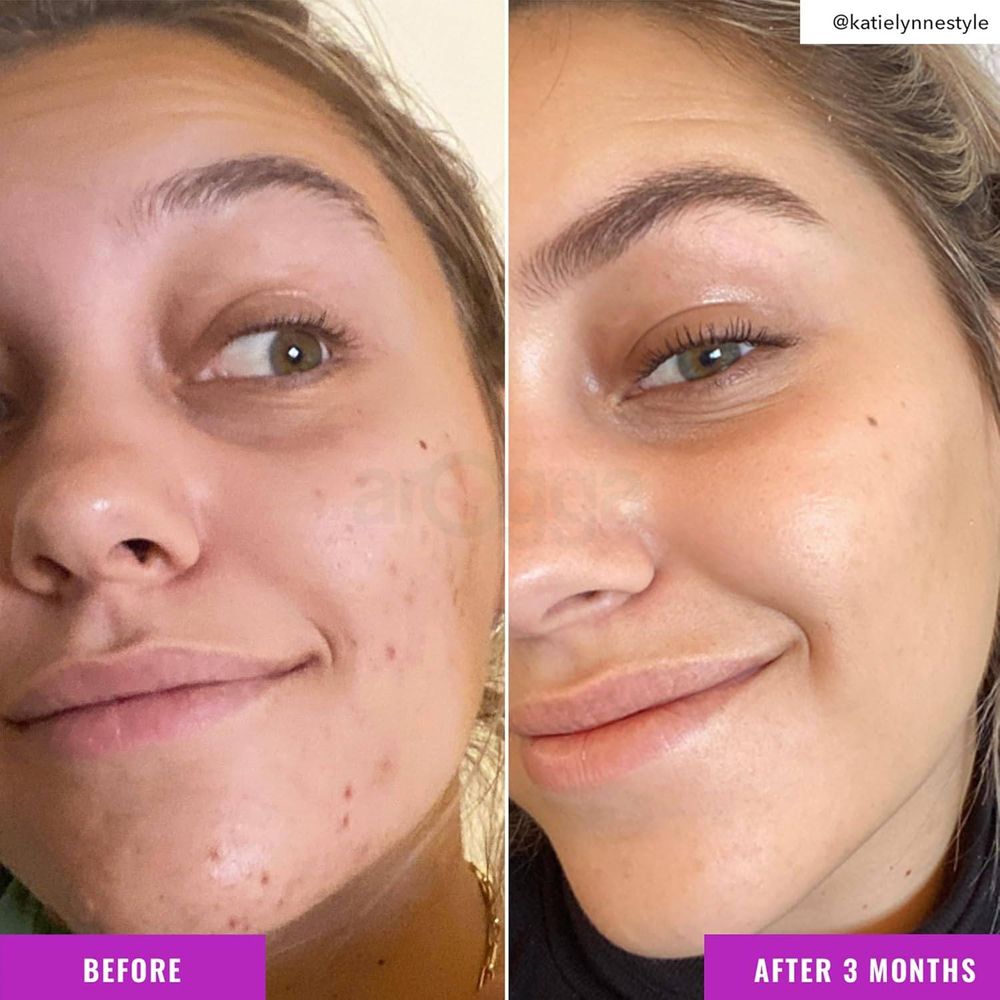 Good Molecules Niacinamide Brightening Toner 120ml  