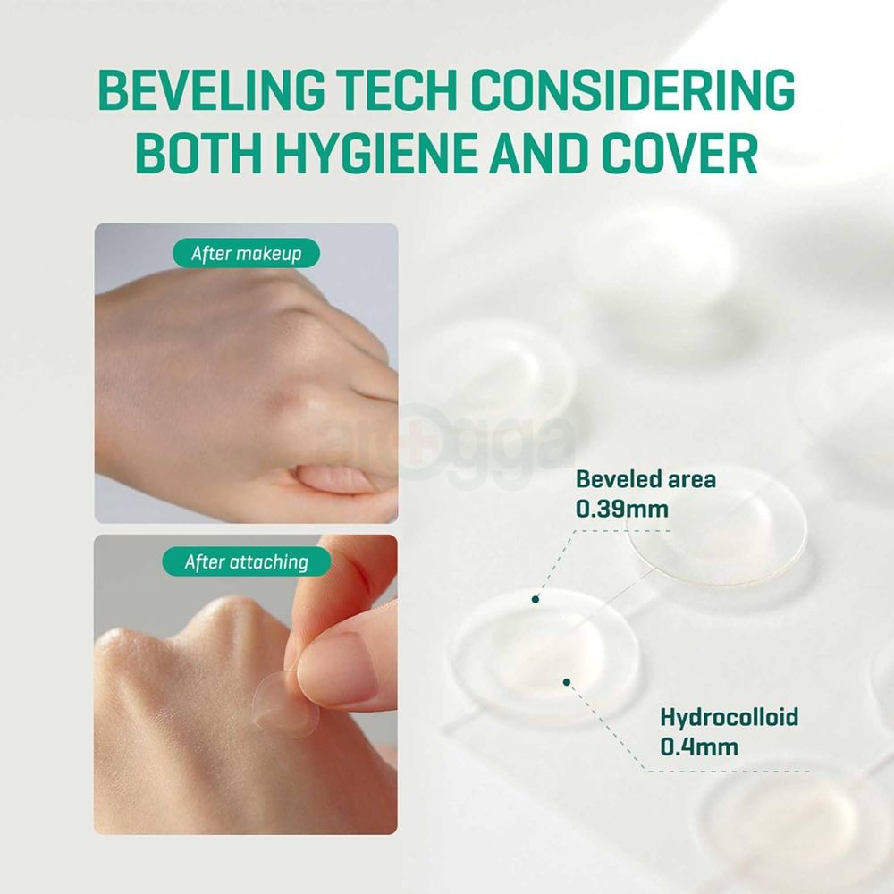 Some By Mi Clear Spot Patch  - 18 Patches  