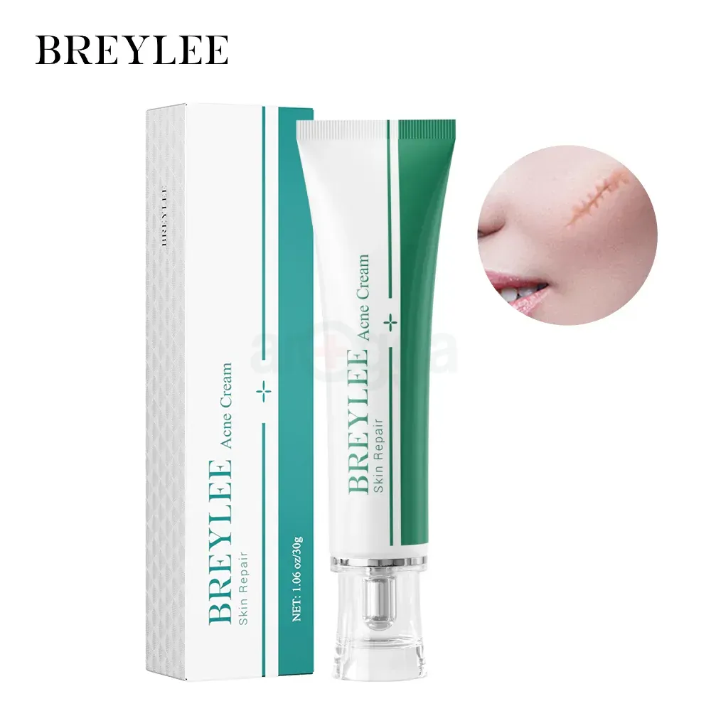 BREYLEE Skin Repair Acne Cream 30g  