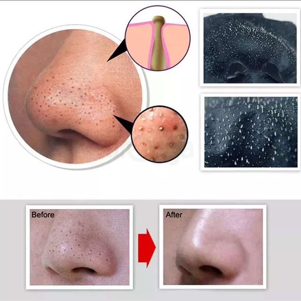 Bioaqua Suck Out Blackhead Mask Mini - 6g  