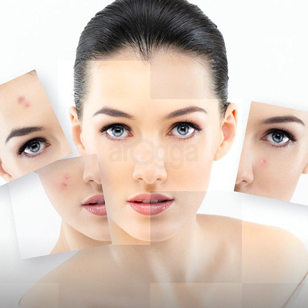 Bioaqua Acne Removal Sheet Mask - 30g  