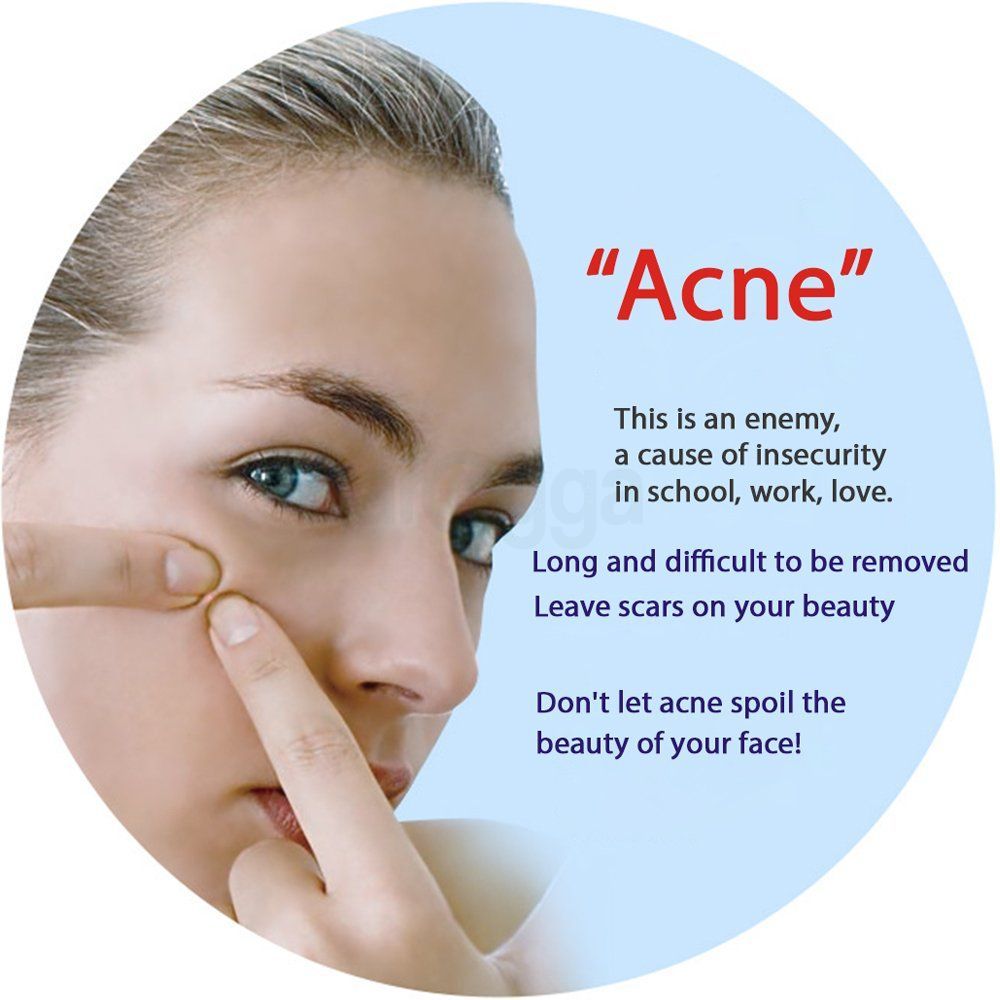 Bioaqua Acne Removal Sheet Mask - 30g  