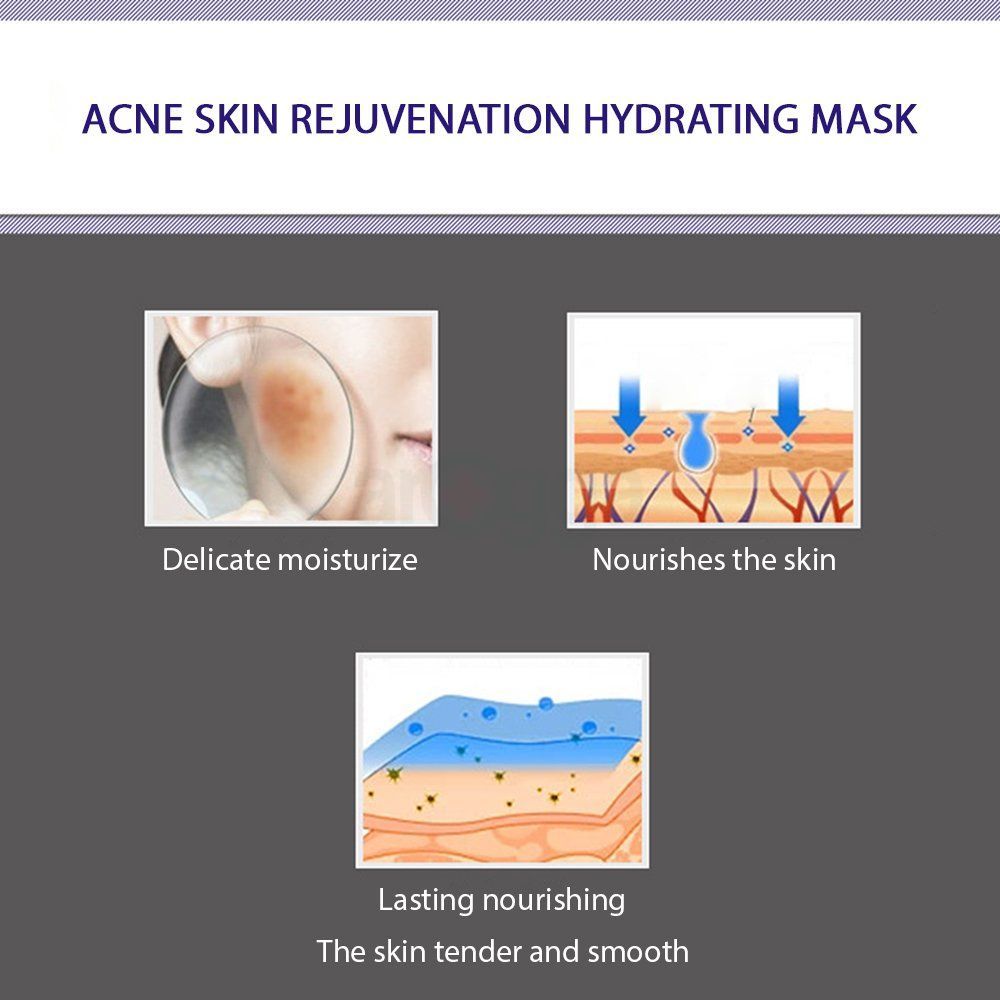 Bioaqua Acne Removal Sheet Mask - 30g  