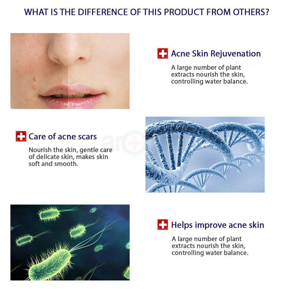 Bioaqua Acne Removal Sheet Mask - 30g  