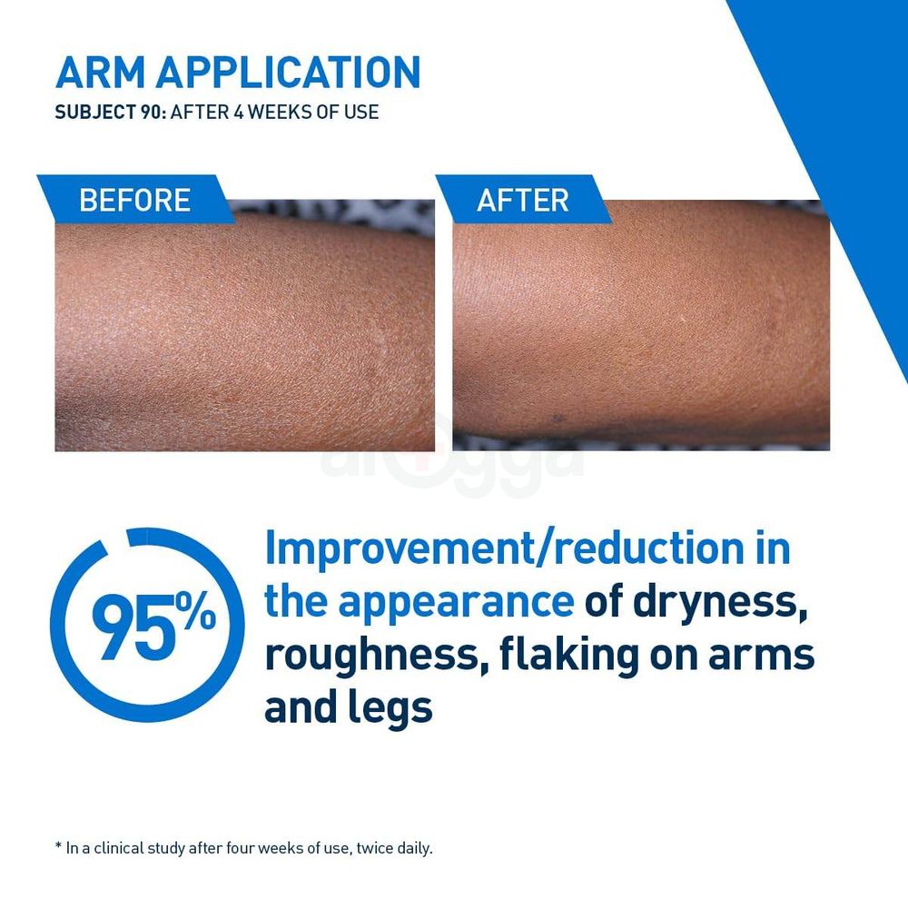 Cerave Intensive Moisturizing Lotion for Dry to Very Dry Skin  