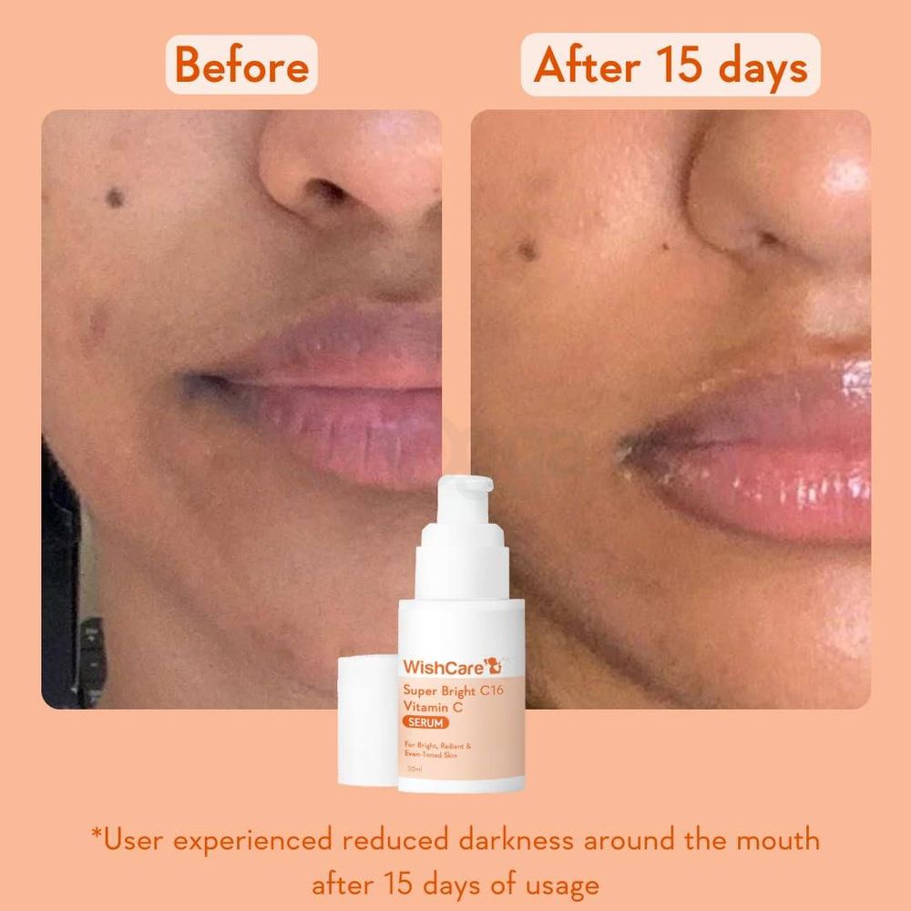 Wishcare Super Bright C16 Vitamin C Serum  