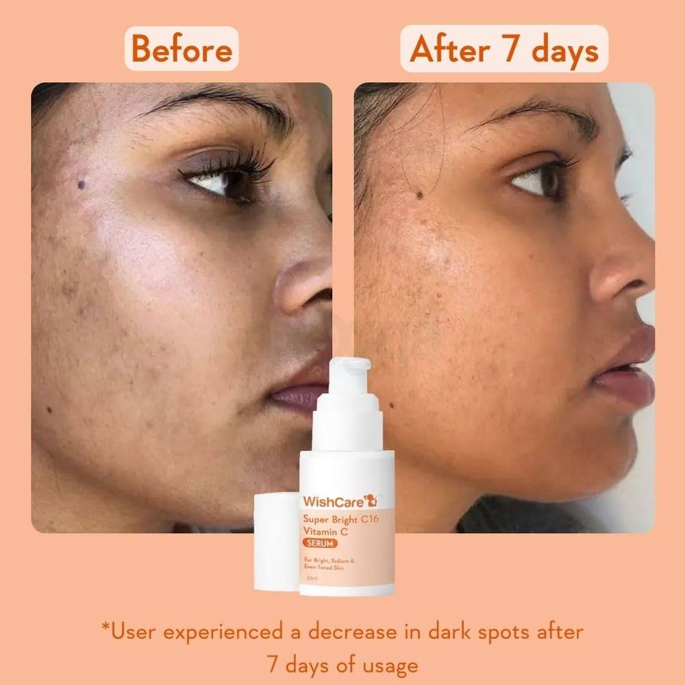 Wishcare Super Bright C16 Vitamin C Serum  