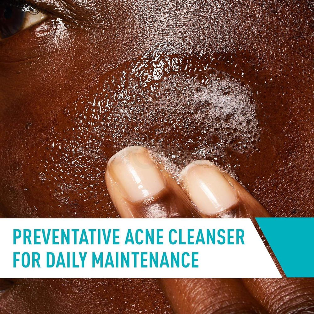 Cerave Acne Control Cleanser with 2% Salicylic Acid Acne Treatment 473ml  