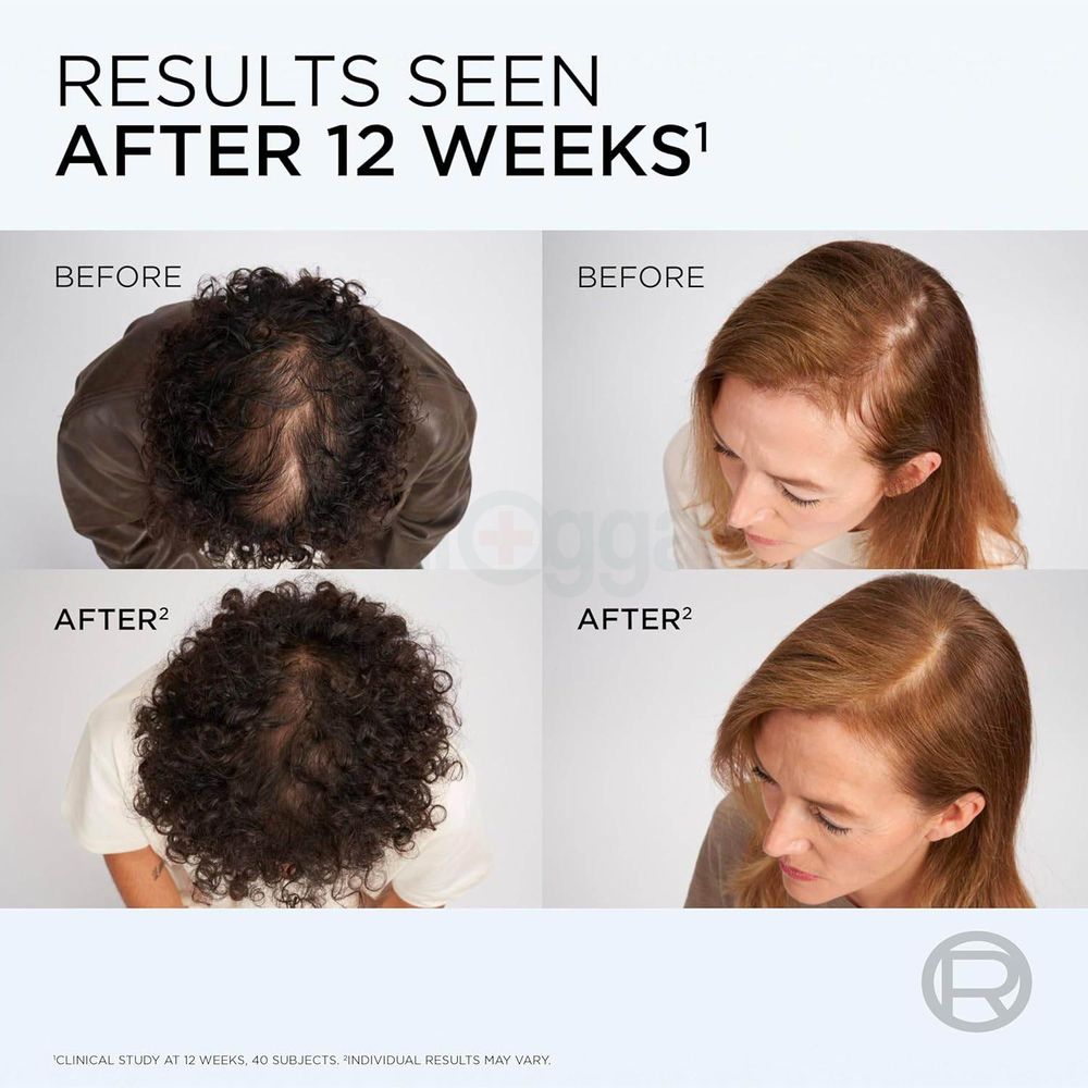 Loreal Paris Silicon Free Growth Booster Anti Fall Conditioner for Hair Prone to Fall & Breakage  