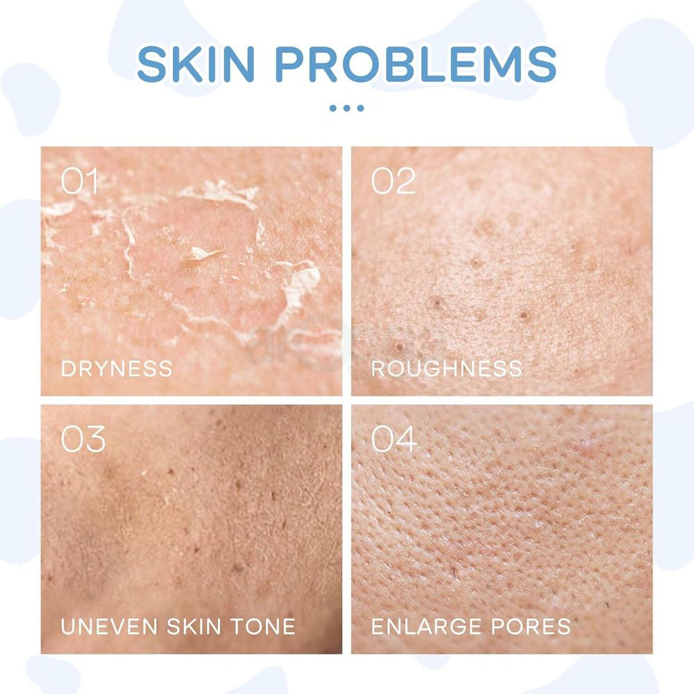 Laikou Milk Skincare 5 Pcs Set (Cleanser + Eye Cream + Mosturizing Cream + Brightening Cream + Sunscreen)  