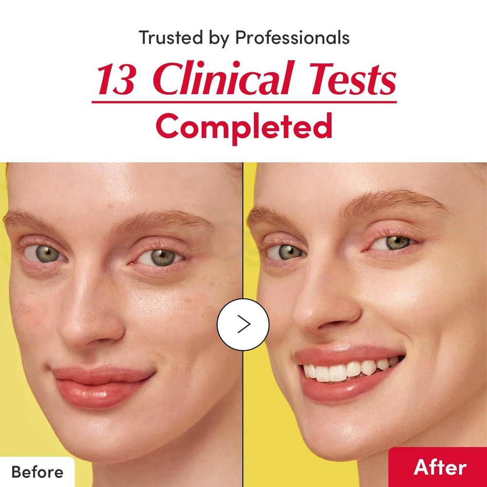 Eqqualberry Deep Cera Vitamin Illuminating Serum with Acerola, Niacinamide. Tranexamic Acid & Ceramide  