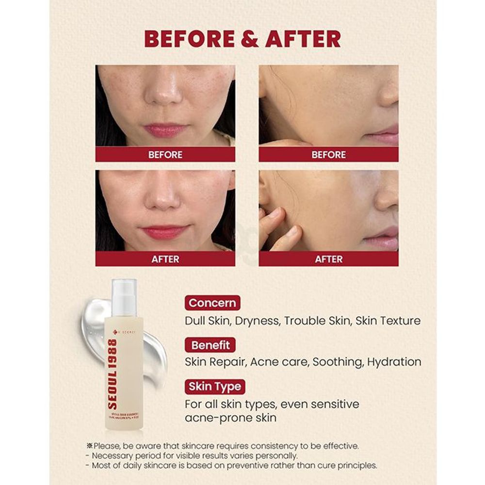 K Secret Seoul 1988 Essence : Snail Mucin 97% + Rice  