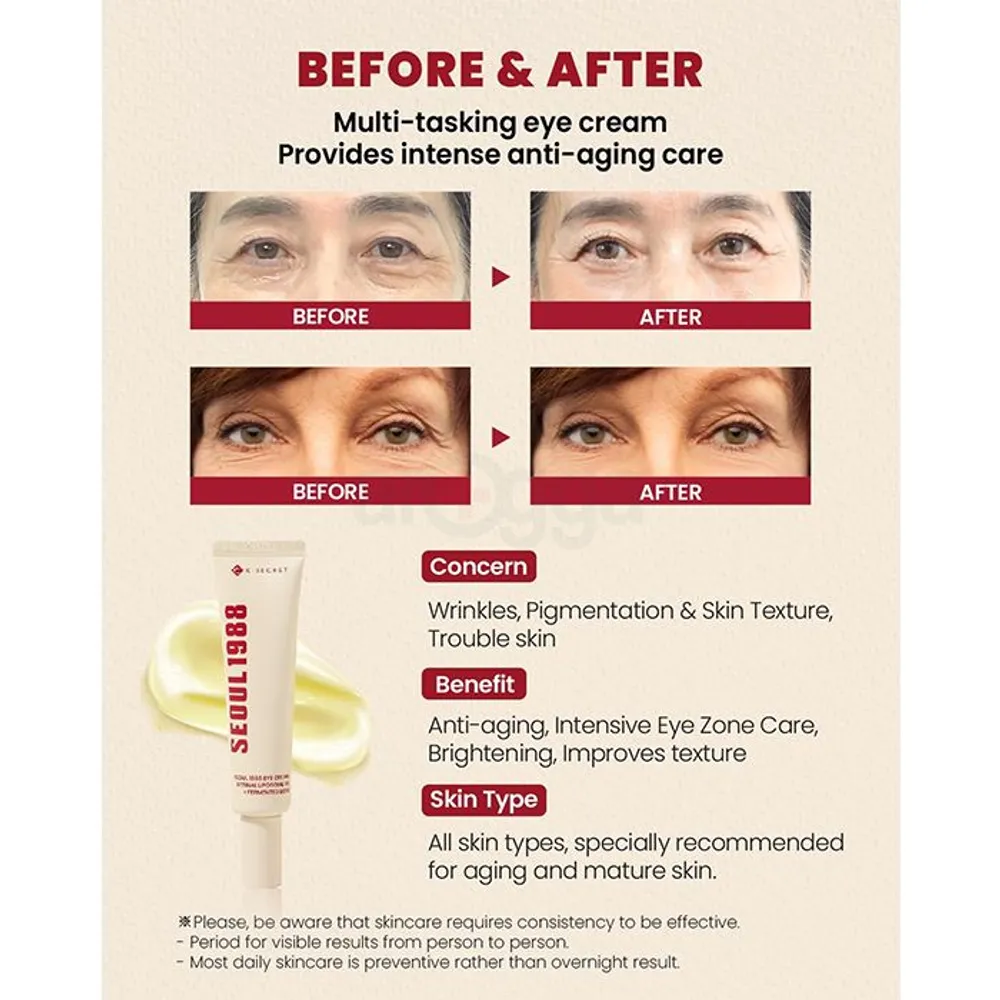 K Secret Seoul 1988 Eye Cream with Retinol Liposome 4% + Fermented Bean  