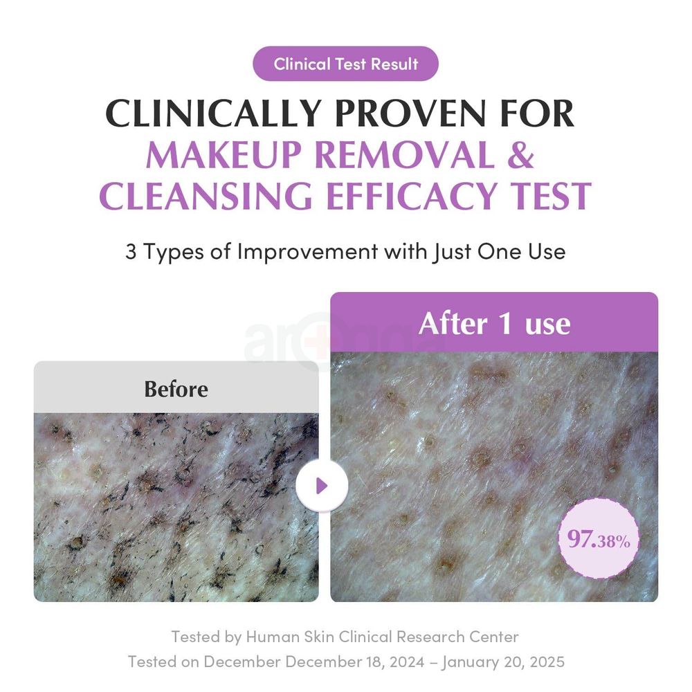 Eqqualberry Purple Rice Pore Soothing Cleansing Oil  